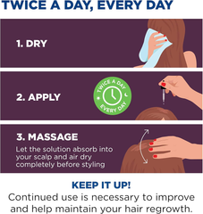 Regaine  Hair Regrowth Treatment for Women, 2 Ounce